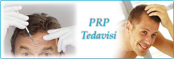 erkeklerde-prp-uygulaması